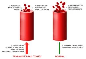 obat darah tinggi dan hipertensi cardiomed