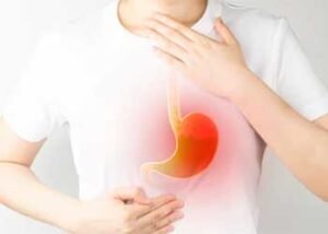 berbagai faktor penyebab asam lambung 